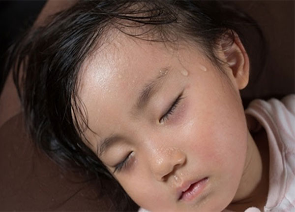 đổ mồ hôi trộm khi ngủ ở trẻ có thể cảnh báo nhiều bệnh nguy hiểm